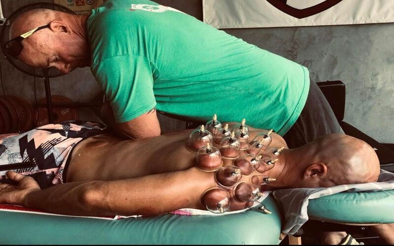 Man receiving cupping therapy on his back